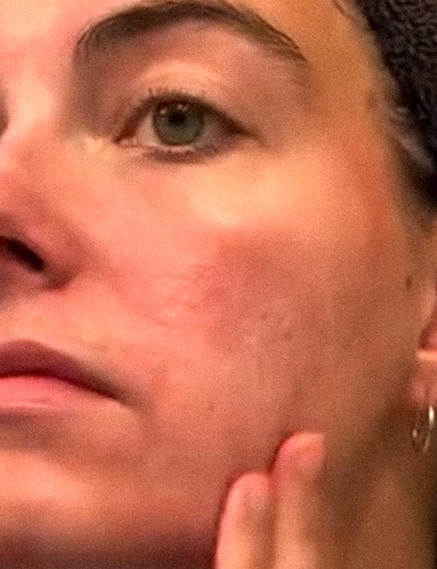 Why Your Skin Gets More Sensitive When You’re Stressed