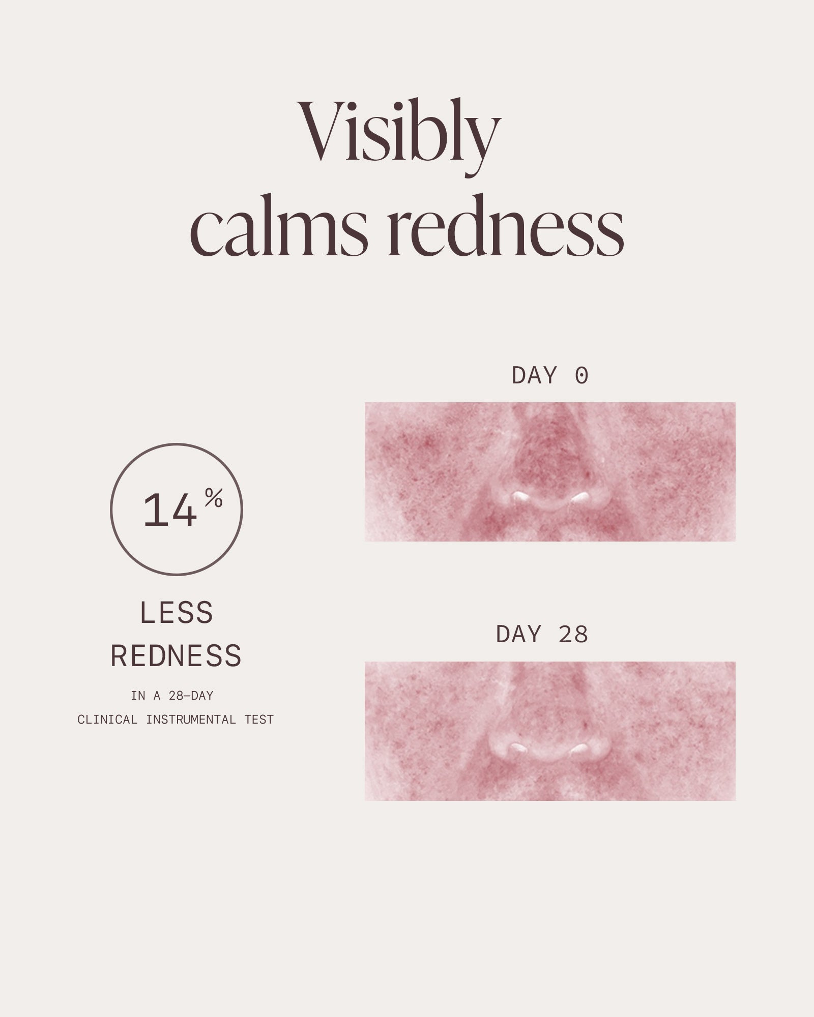 Clinical results showing redness reduction after 28 days, soothing serum for sensitive skin reduces visible redness